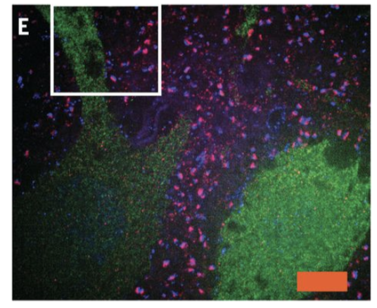 Saving the human brain connectome using Machine Vision